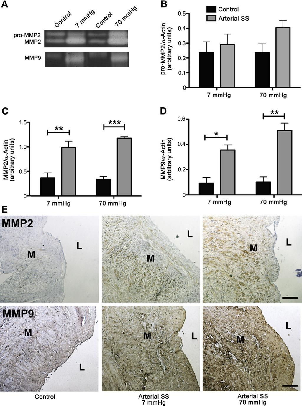 Volume 57, Number 5 Berard et al 1377 Fig 4. The lytic activity of matrix metalloproteinase (MMP)-2 and MMP-9 is increased by arterial shear stress (SS) and blood pressure.