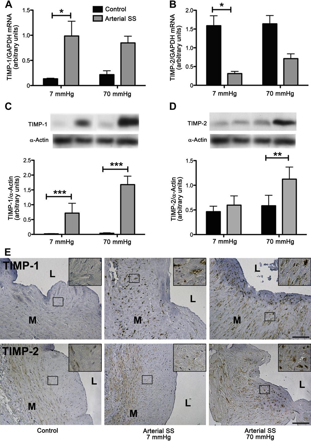 1378 Berard et al May 2013 Fig 5. The inhibitors of tissue inhibitor of metalloproteinase (TIMP)-1 and TIMP-2 are differentially affected by arterial shear stress (SS) and pressure.