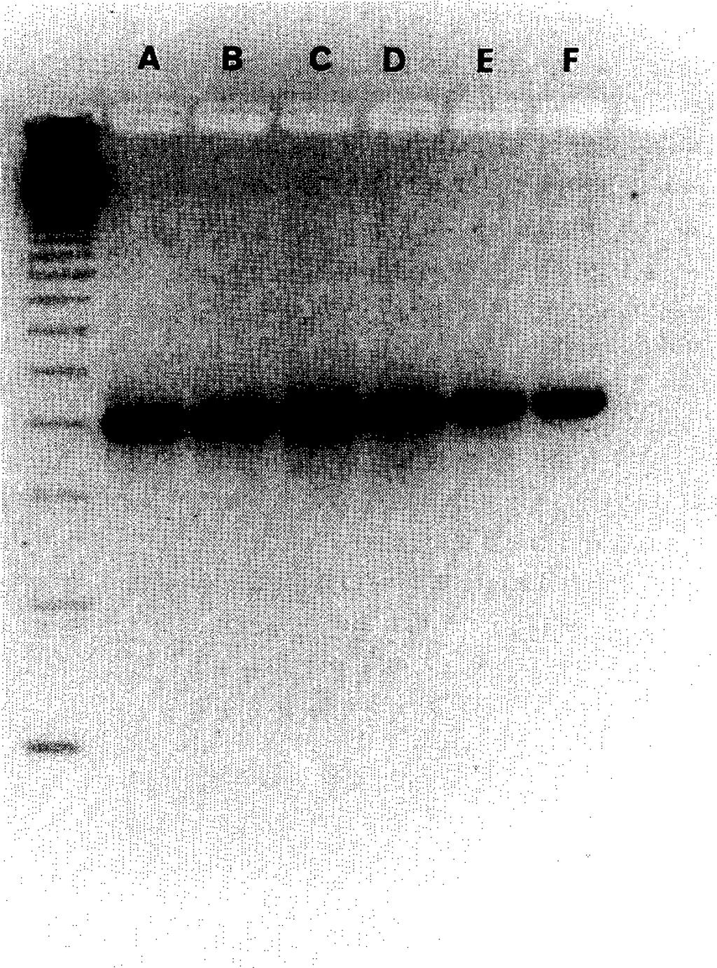 Von Lubitz et al. Page 10 NIH-PA Author Manuscript NIH-PA Author Manuscript NIH-PA Author Manuscript Fig. 1. RT-PCR products obtained from 3 different regions of mouse brain and separated on a 3.