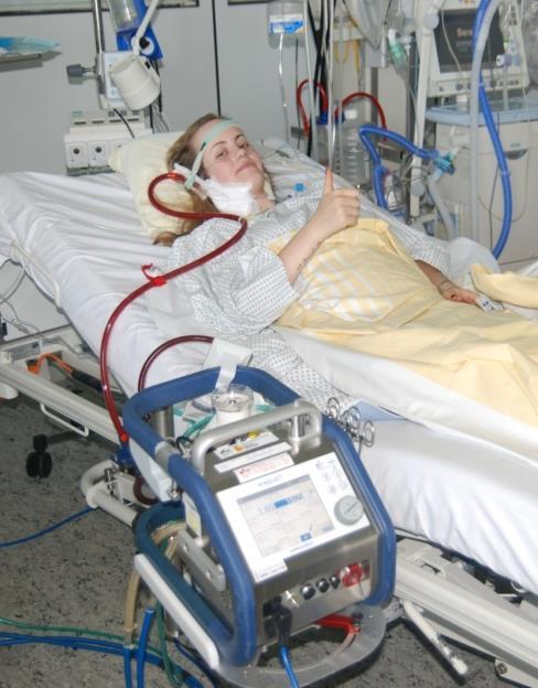 Conclusion: ECMO: a breakthrough in care for respiratory failure? 1. ECMO safes lifes. 2.