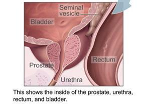 The Prostate The role of the