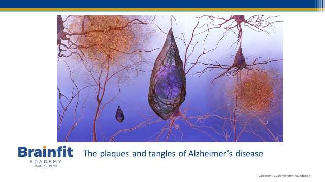 However, Alzheimer s is not just a disease of old age. Up to 5% of the people with the disease have early onset Alzheimer s which can appear when someone is in their 40s or 50s.