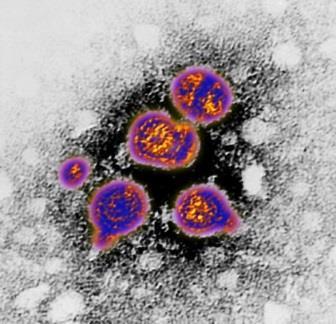How is hepatitis B virus (HBV) transmitted?
