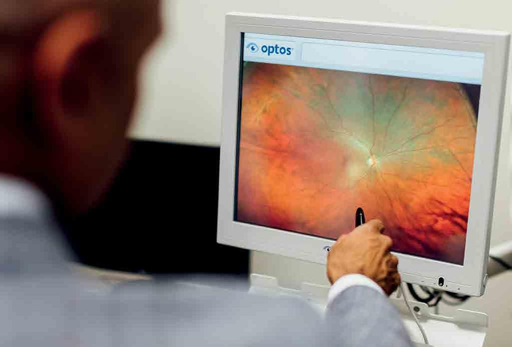 How is diabetic retinopathy diagnosed? Your ophthalmologist will examine both retinas after using eye drops to make your pupils larger and allow a clear view of the back of each eye.