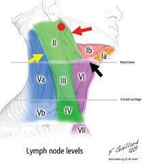 Anatomy lymphatic drainage Subsite Common Level of Regional Lymph Node Metastasis Upper lip Ipsilateral level IB, perifacial, periparotid, level II Lower lip Upper alveolar ridge Lower alveolar ridge