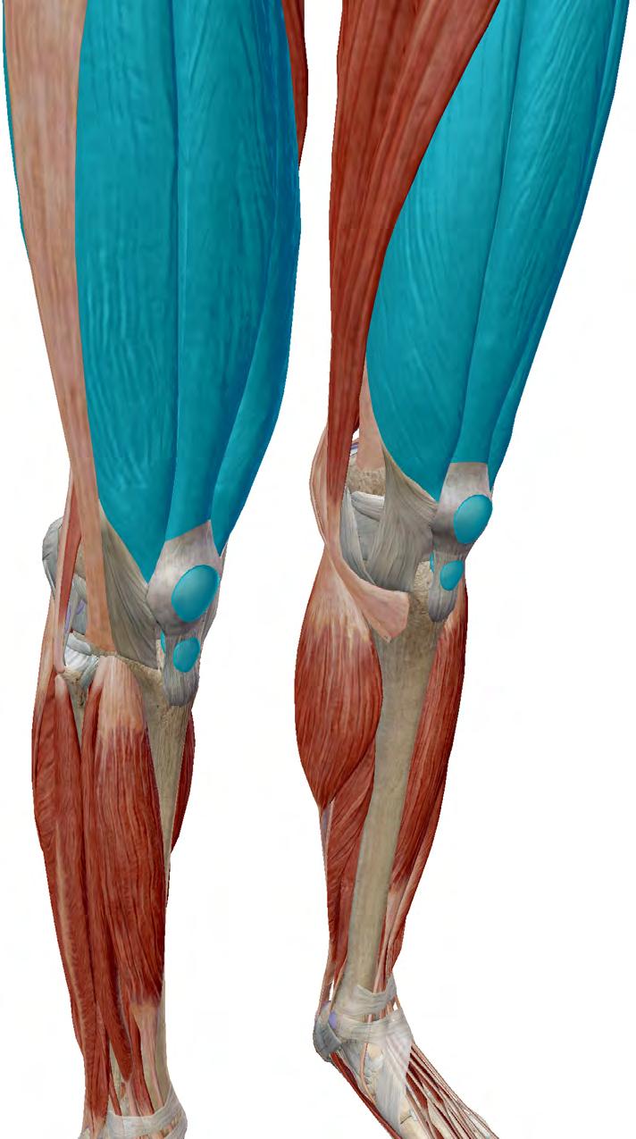 SESAMOID BONES patella quadriceps femoris Sesamoid bones are embedded in tendons. The most notable example of a sesamoid bone is the patella.