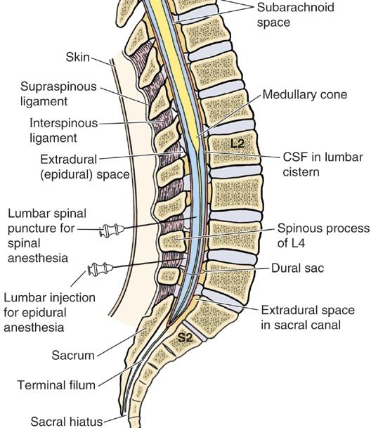 Lumbar puncture For CSF in the subarachnoid space