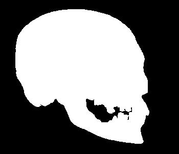 Skull Anatomy The skull is