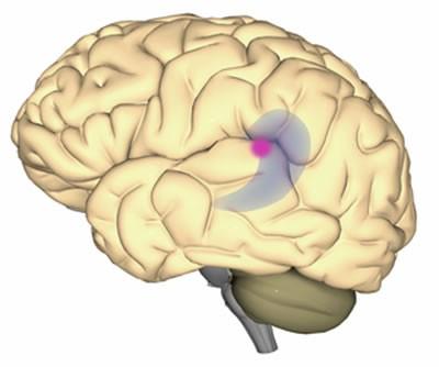 Language Auditory Association Area Wernicke s area is a specialized portion of the parietal lobe that recognizes and understands written and spoken language.
