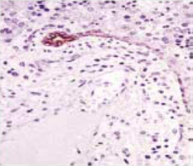 Fetal liver Fetal liver Adult liver Ductal Plate Hepatoblasts