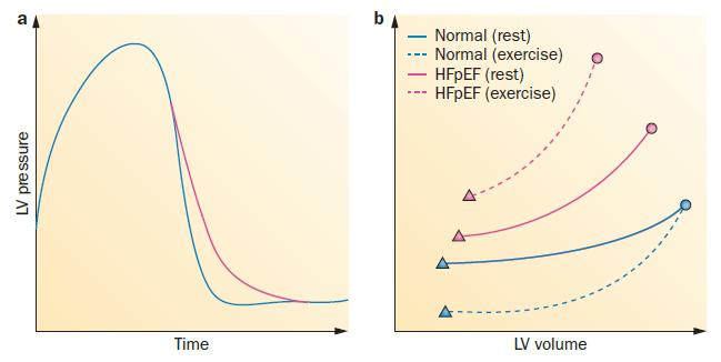 Pathophysiology of HFPEF: Diastolic dysfunction Ox stress/ NO bioavailability Stiff titin