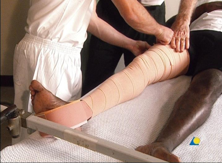 A second, proximal bandage ensures that the adhesive strip is secured as far as the groin.