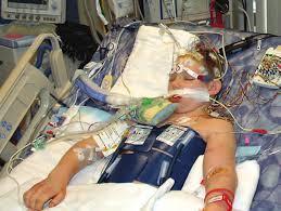 Hypothermia & PALS Comatose children resuscitated from OHCA: Maintain 5 days of normothermia, or