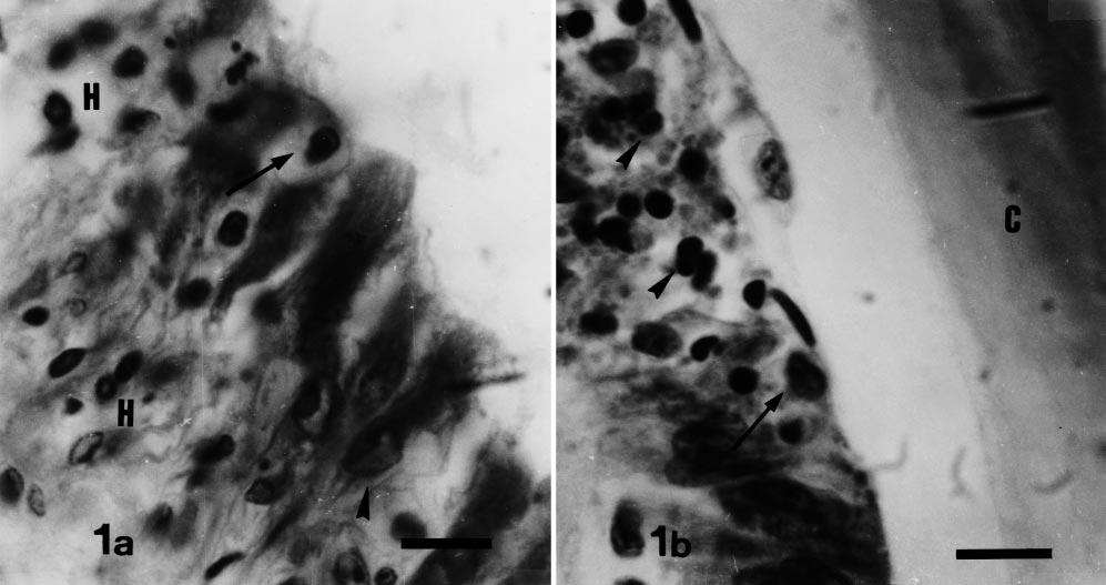 Jimenez et al.: Seasonal shrimp virus in Ecuador 93 Fig. 1. Photomicrographs of histological sections of acute infectious cuticular epithelium necrosis (ICEN) in Penaeus vannamei.