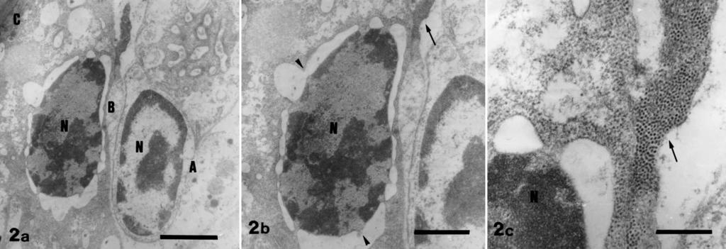 94 Dis Aquat Org 42: 91 99, Fig. 2. Transmission electron photomicrograph of subacute ICEN disease.