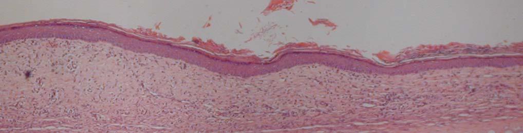 Methods Epidermal Thickness Index ETI Histology -Counting of the area of