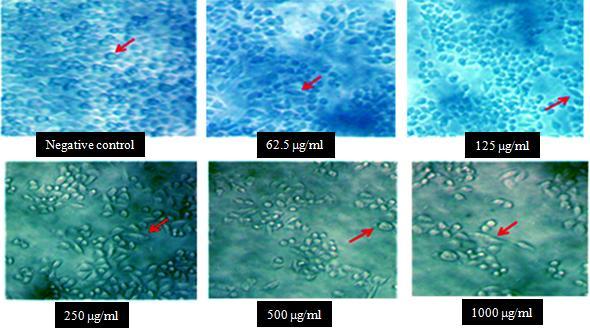 KB cells after treated with various concentrations of extract for 24 hours In the culture cell, the growth of KB cell was inhibited with the various concentration of ant nest plant extract.