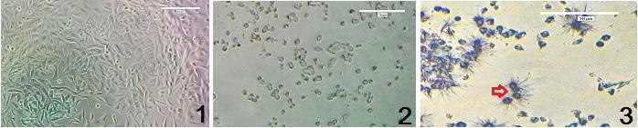 Figure 1: The morphological changes of T47D cells before and after the treatment observed using inverted microscope. 1) Control cells.