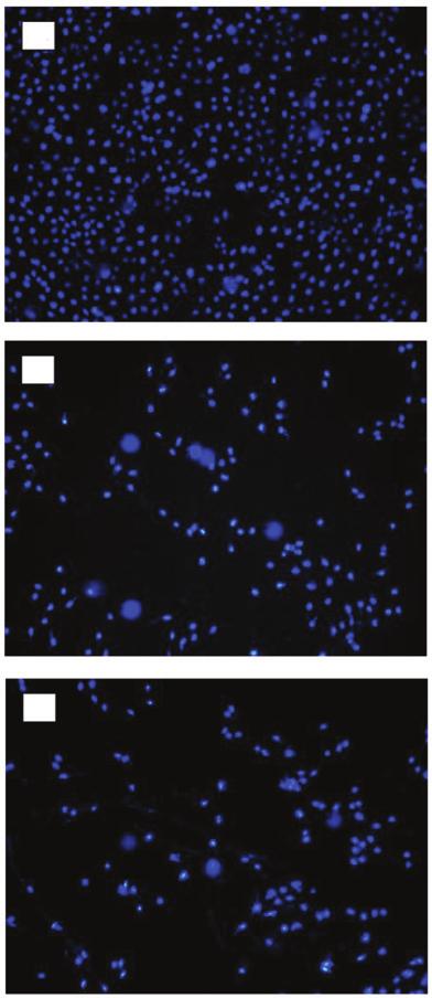 EXPERIMENTAL AND THERAPEUTIC MEDICINE 10: 579-583, 2015 581 A Figure 1. Effect of quercetin on the proliferation of SKOV 3 cells. B A C B C Figure 3. Apoptosis determination by Hoechst 33258 staining.