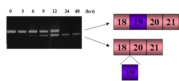 Fig. 1. Schematic representation of exon 19 of dystrophin Kobe. In the pre-mrna sequence (upper line), 52 bp of the 88 bp of exon 19 of the dystrophin gene are deleted in dystrophin Kobe.