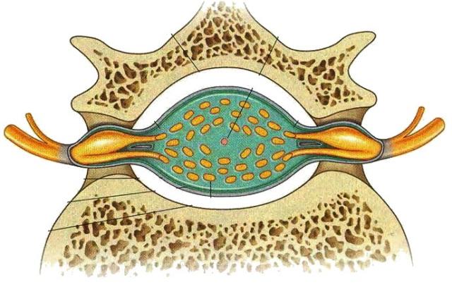 Level of Lumbar Puncture Conus medullaris - 1.