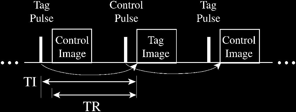METHODS FIG. 1. Schematic diagram of turbo ASL pulse sequence. The first two of these apply to pulsed ASL in general, while the third applies only to turbo ASL, in which TI TR.