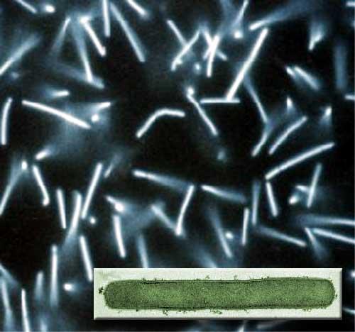 Symbiotic Rhizobium bacteria invade the roots of