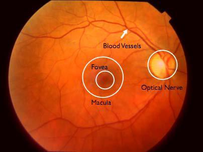 Intelligent Diabetic Retinopathy Diagnosis in M. Zahmatkesh, A. Rafiee, M. Mazinani screening for early detection of DR. Retinal images have several parts like optic disc, vessels, macula and fovea.