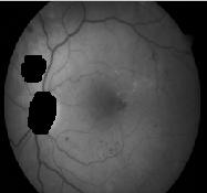 Figure 9, is showing the result of applying proposed optic disc detection algorithm with true, false and no detection on the images of Diaretdb0, Diaretdb1databases. (c) Figure 9.