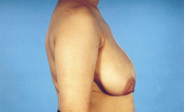 A B C D Figure 10 A 38-year-old patient with breast