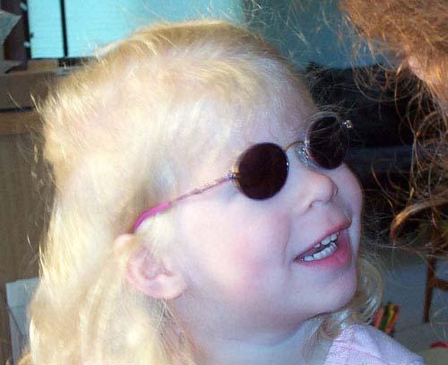 Albinism Albinism is the absence of or a reduction in the pigment in the skin, eye, or both (Traboulsi, 2003).
