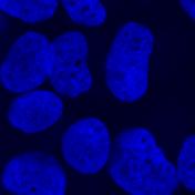 HA-FANCI DAPI Cells with HA-FANCI foci (%) 100 80 60 40