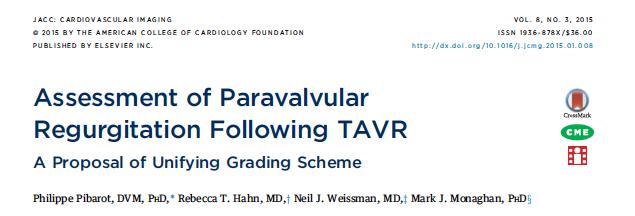 Assessment of Prosthetic Aortic Valve Regurgitation: TEE Identifies: