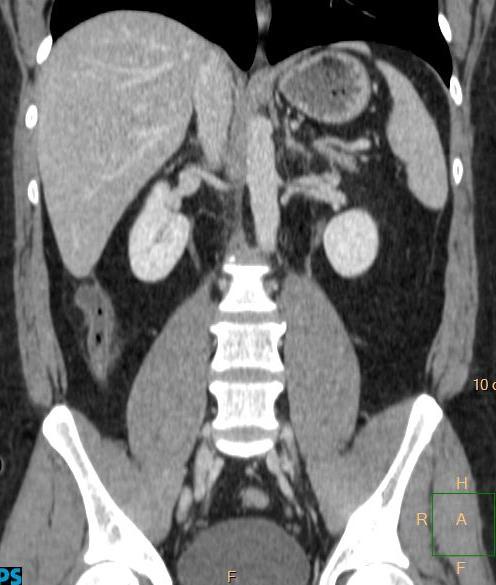 man. MDCT with intravenous