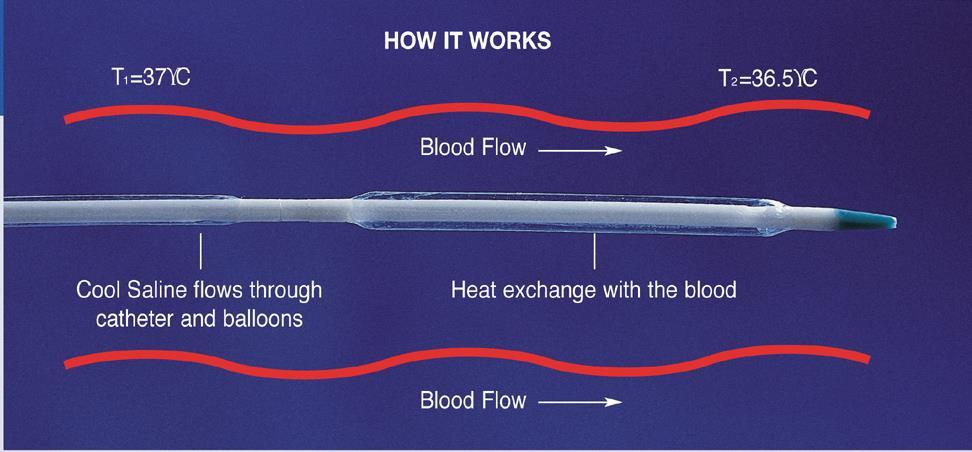 How The Heat-Exchange Works
