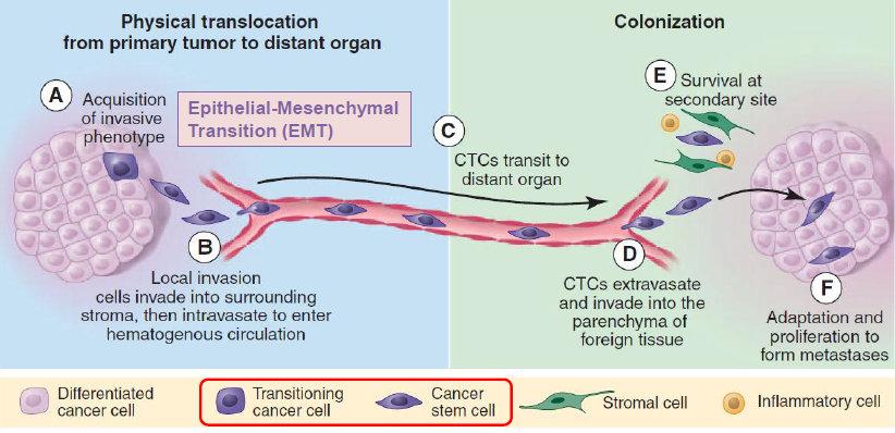 Tumor Metastasis and Circulating Tumor Cells (CTC)