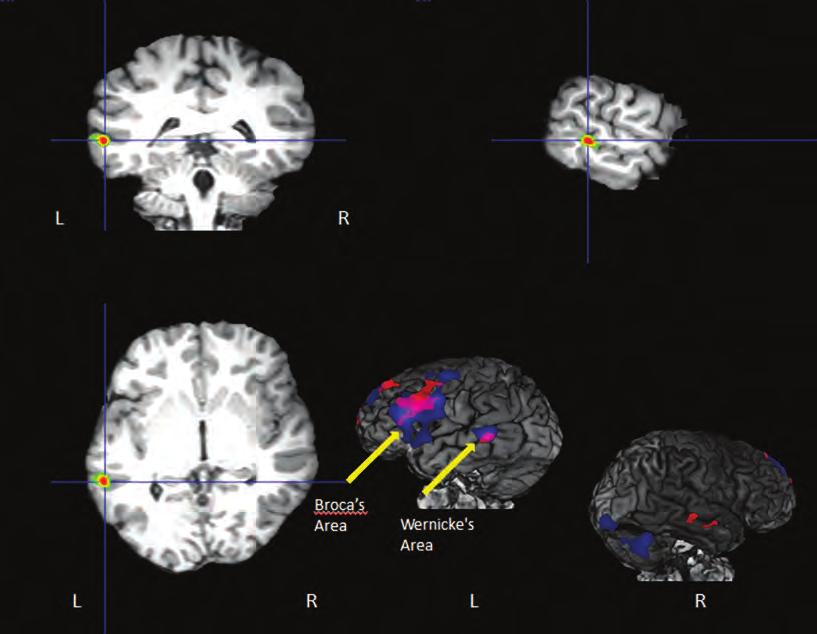 Clinical Neuroimaging A Figure 1 A.