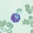 Anaplasmosis Anaplasma phagocytophilum WHERE FOUND Anaplasmosis is most frequently reported from the upper midwest and northeastern U.S.