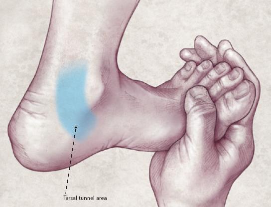 Physical Examination Special Tests (Cont ) Dorsiflexioneversion test to