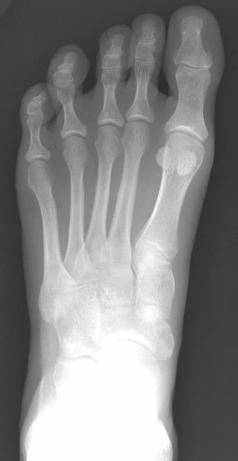 X-ray (AP,