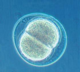 100 μm (b) Growth and development. This micrograph shows a sand dollar embryo shortly after the fertilized egg divided, forming two cells (LM). 20 μm Figure 12.2 The functions of cell division.
