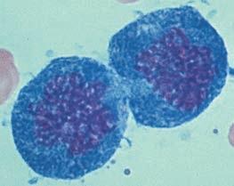 These dividing bone marrow cells will give rise to new blood cells (LM).