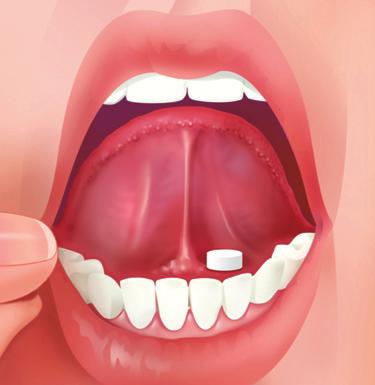 Administration tips SUBOXONE sublingual tablets should be placed under the tongue until dissolved.