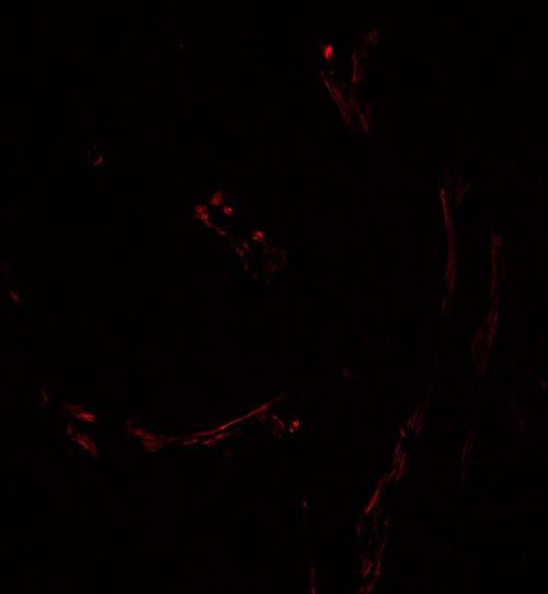 tumours (n=8) stained for SMA,