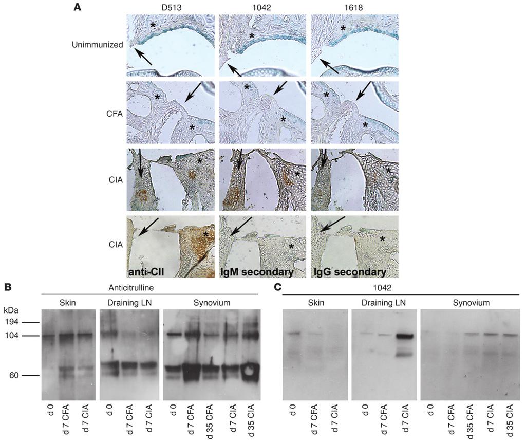 Figure 5 D513, 1042, and 1618 monoclonal antibodies bind antigens within the inflamed synovium of mice with CIA. (A) Immunohistochemistry was performed using 4 μg/ml D513, 1042, and 1618.