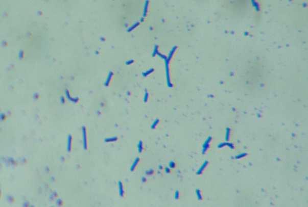 1% Table 1: The bacteriocin test results Concentrations of HA(%) Bacillus subtilis (diameter zones{cm}) Bacillus cereus (diameter