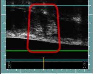 Use of Ultrasound for Anatomic Feature Analysis