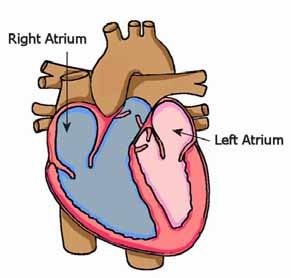 During AF, the heart s two upper chambers (atria) beat out of coordination with the two lower chambers. The atria do not empty all of the blood, which can cause the leftover blood to form clots.