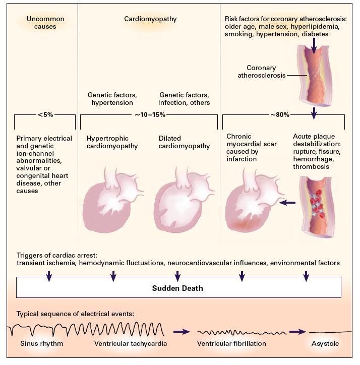 Etiology of Sudden Cardiac Death Huikuri et al. N Engl J Med, Vol.