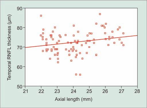Assessment of Retinal Nerve Fiber Layer Changes by Cirrus High-definition OCT in Myopia A B C Graphs 2A to D: Scatter plots of the RNFL thickness in each quadrant against the axial length D decreased